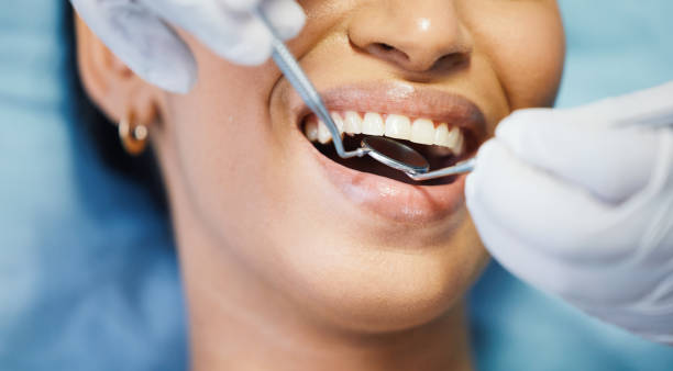 Best Emergency Tooth Extraction in Central City, KY