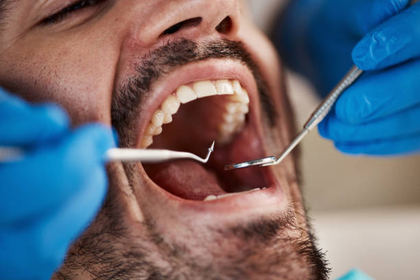 Best Emergency Denture Repair in Central City, KY
