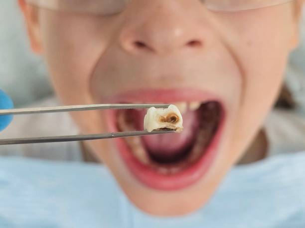 Best Pediatric Emergency Dentist in Central City, KY