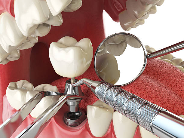 Best Emergency Gum Treatment in Central City, KY